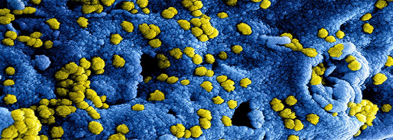 Coronavirus-nucleocapaside-(N)-y-espicula-(S)