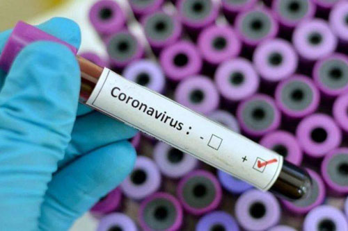 Muestra de coronavirus de china