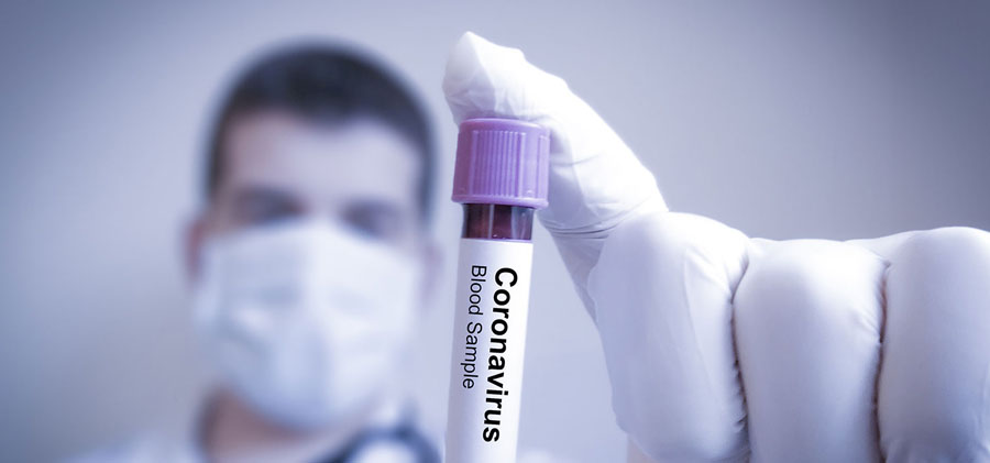 Muestra de sangre para despistaje del coronavirus